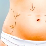 Does plastic surgery get you a better man?